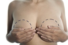 Odszkodowanie po nieudanej operacji plastycznej piersi