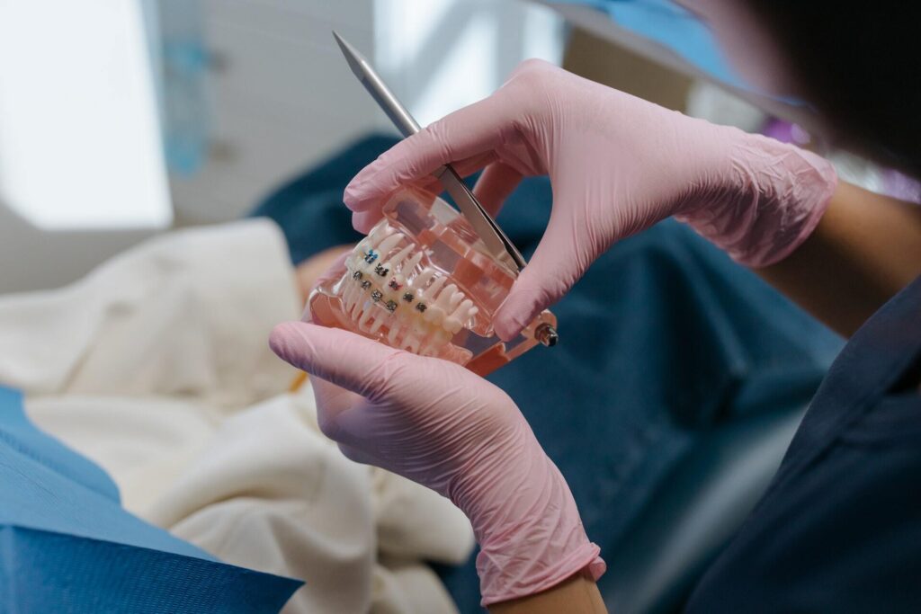 Aparat ortodontyczny – czym jest i kiedy warto się zdecydować